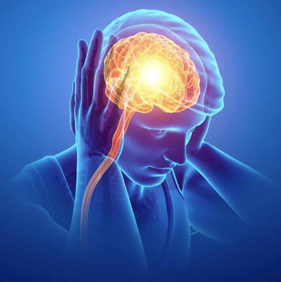 Treatment of migraine with electropuncture